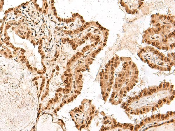 ARMC8 Antibody
