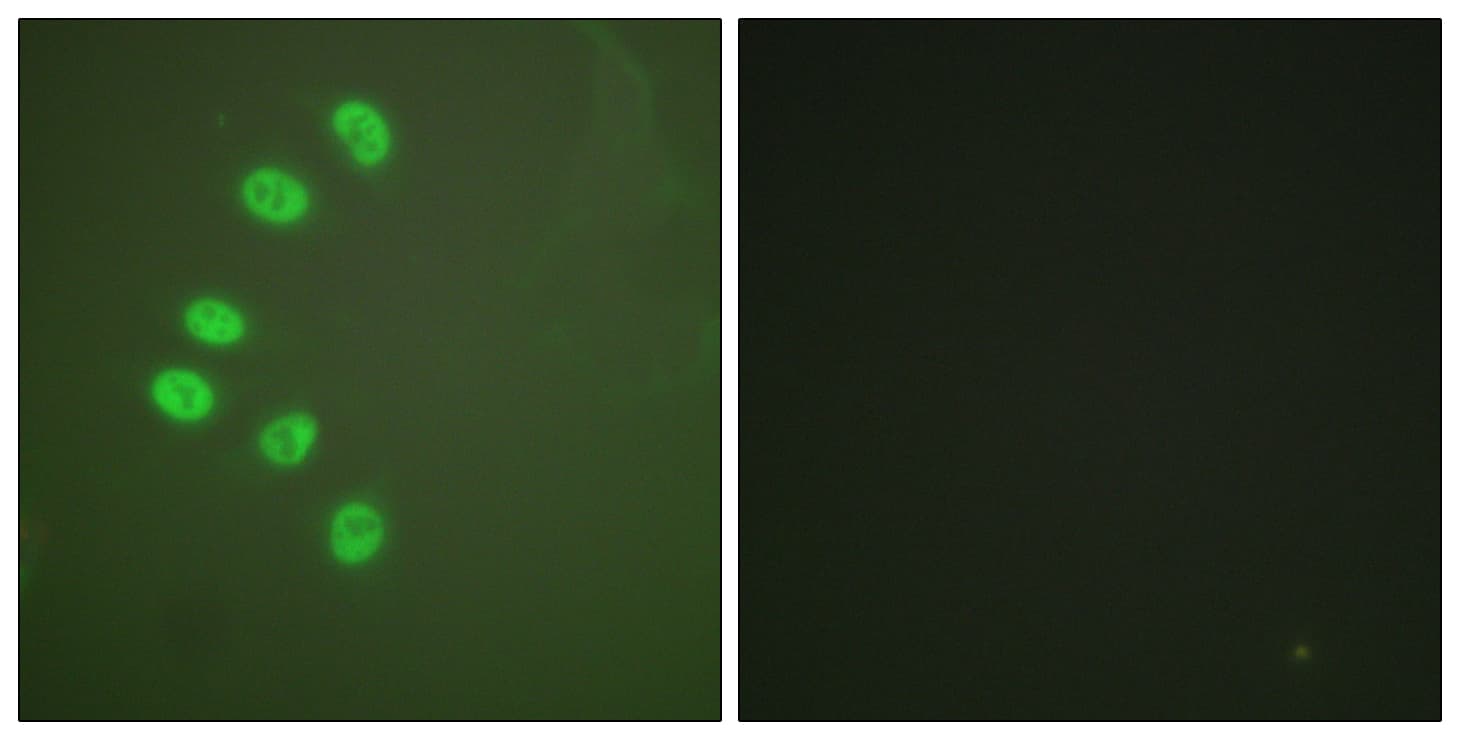 Polyclonal Rabbit anti-Human PR / Progesterone Receptor Antibody (aa261-310, IHC, IF)