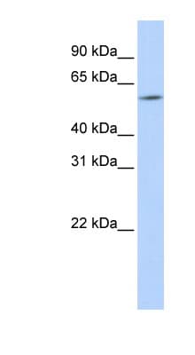 ARX Antibody (aa216-265)