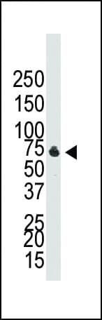 ALK-6 / BMPR1B Antibody (aa472-502)