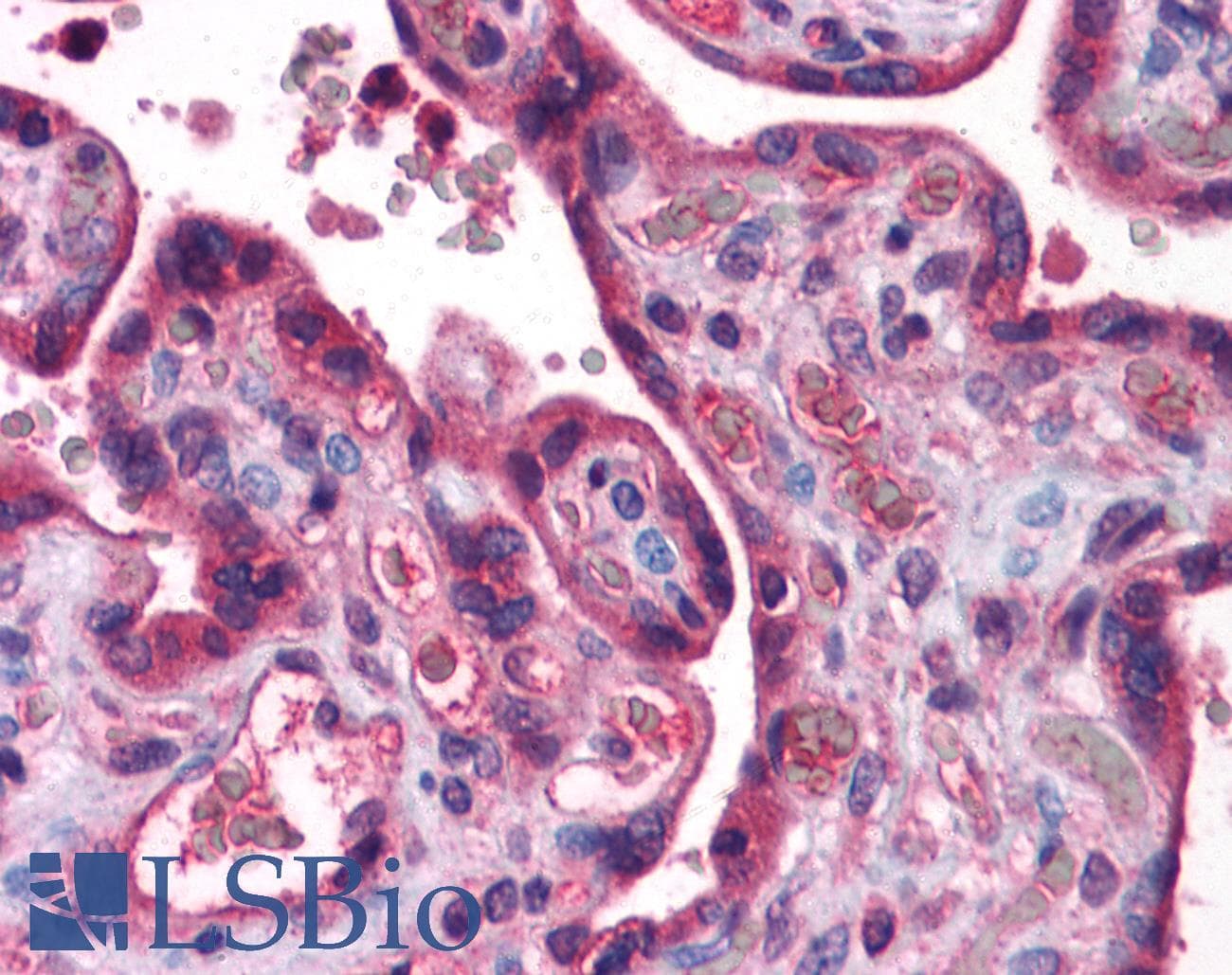 Polyclonal Rabbit anti-Human FACL2 / ACSL1 Antibody (aa619-668, IHC, WB)