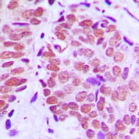 Polyclonal Rabbit anti-Human XRCC5 / Ku80 Antibody (C-Terminus, IHC, WB)