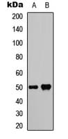 Polyclonal Rabbit anti-Human SMYD2 Antibody (Internal, WB)