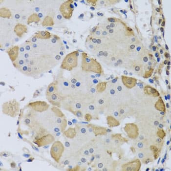 ANAPC10 / APC10 Antibody (AP)