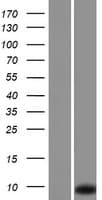 RPLP1 Protein (Over-Expression Lysate Myc-DDK (Flag))