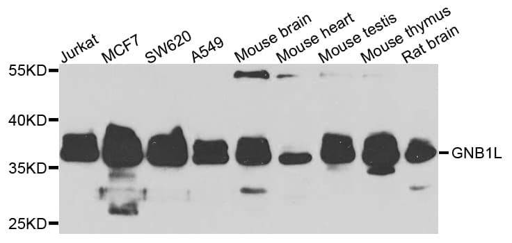 GNB1L / FKSG1 Antibody
