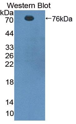 CTTN / Cortactin Antibody (aa1-509)
