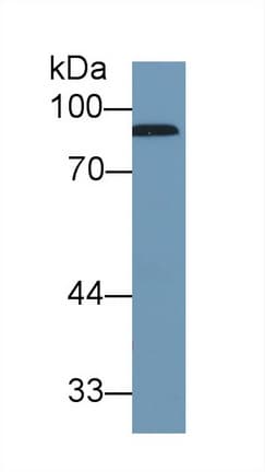 CFB / Complement Factor B Antibody (aa477-600, Cy3)
