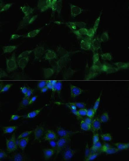 HSP90AA1 / Hsp90 Alpha A1 Antibody
