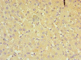 P5CDH / ALDH4A1 Antibody (aa354-563)