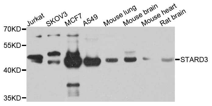 STARD3 / MLN64 Antibody