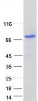 Human SARM1 / SARM Protein (Recombinant Myc-DDK (Flag))