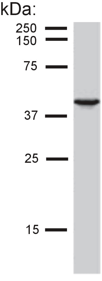 PathPlus™ Monoclonal Mouse anti-Human KRT19 / CK19 / Cytokeratin 19 Antibody (clone BA-17, IHC, WB)