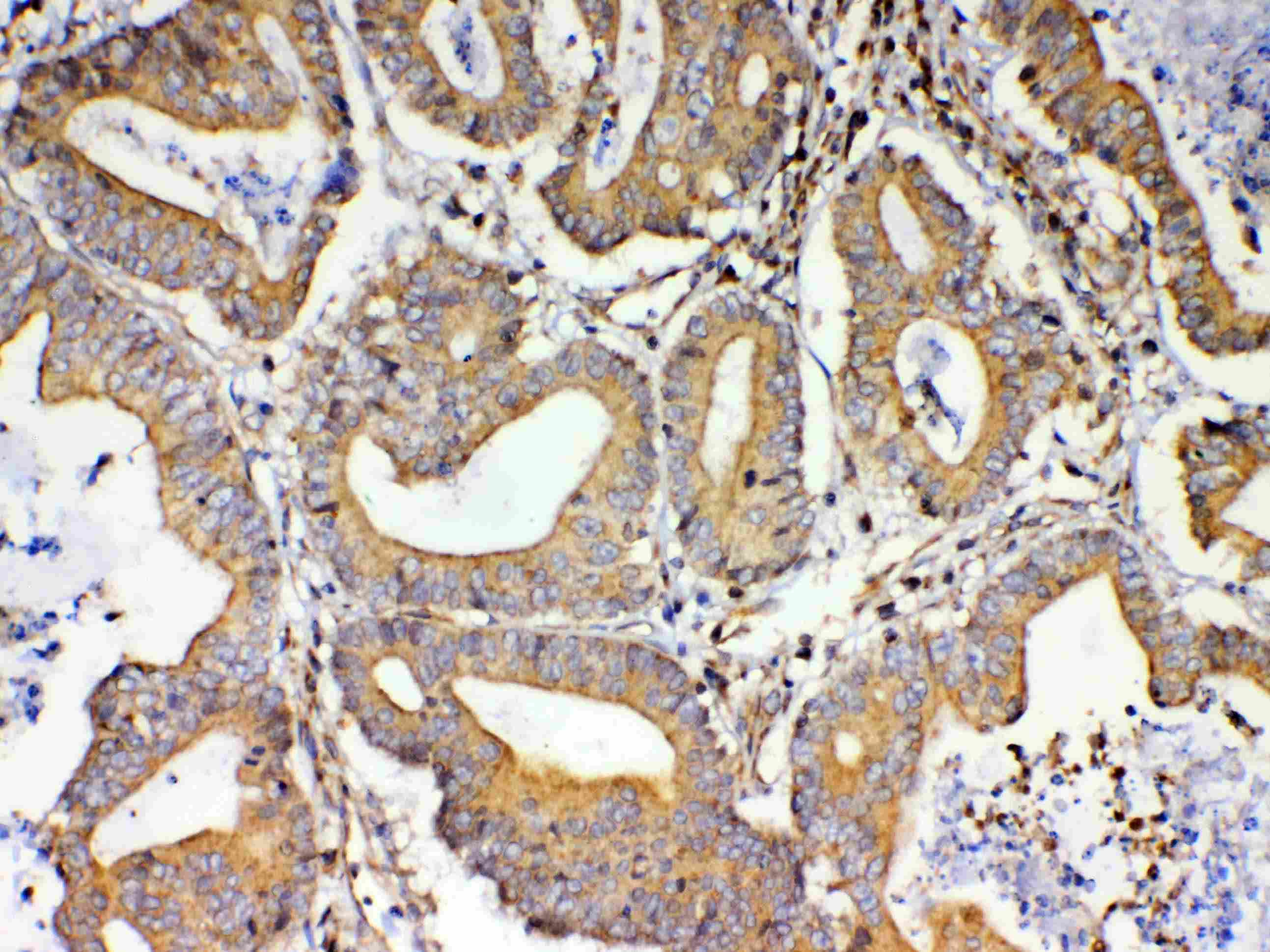 Polyclonal Rabbit anti-Human TSPAN12 Antibody (IHC, WB)