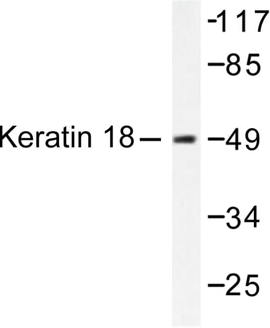 KRT18 / CK18 / Cytokeratin 18 Antibody (Pro27)