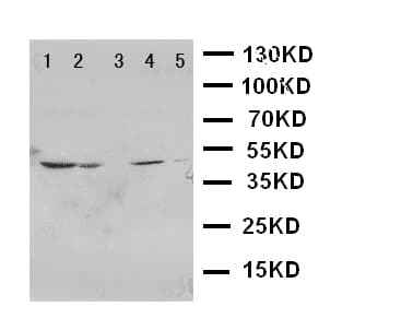 PTGER1 / EP1 Antibody (aa387-404)