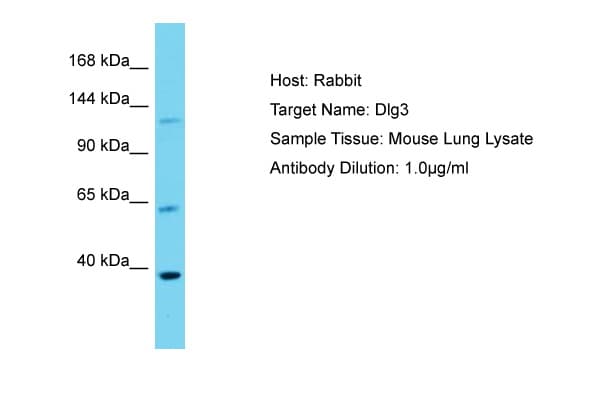 DLG3 / SAP102 Antibody (aa201-250)