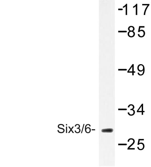 SIX3 + SIX6 Antibody (Asp228)