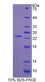 Human FGF11 / FGF-11 Protein (Recombinant His, N-Terminal)