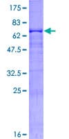 Human CPB2 / TAFI Protein (Recombinant GST)