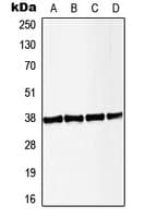 LAT Antibody (phospho-Tyr191)