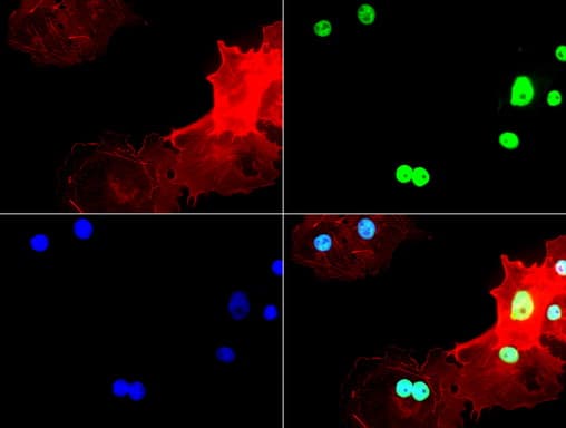 TP53 / p53 Antibody (clone UMAB55)