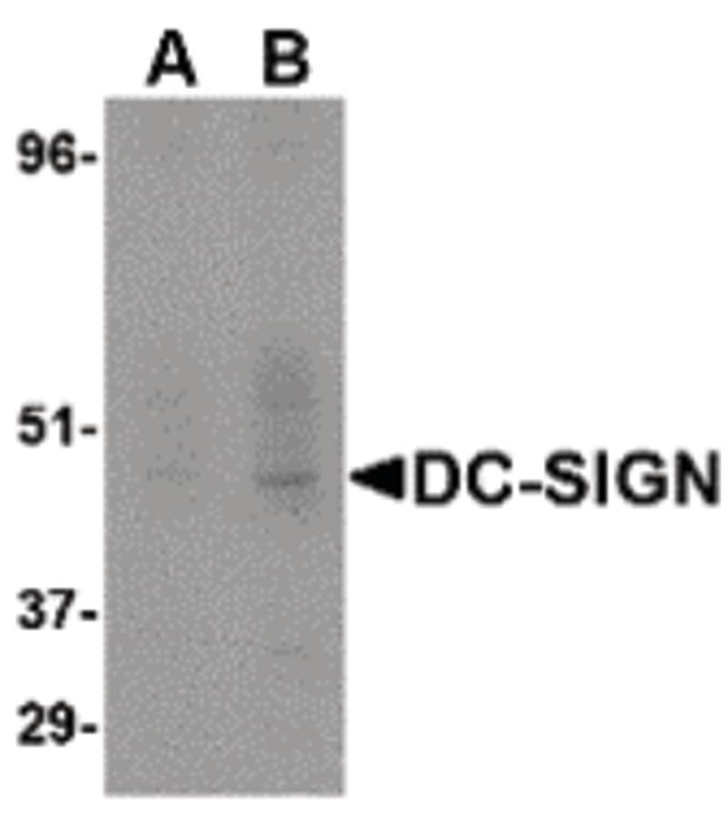 IHC-plus™ CD209 / DC-SIGN Antibody (clone 5D7)
