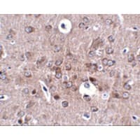PCDH18 Antibody
