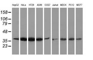 ANXA3 / Annexin A3 Antibody (clone OTI1A9, Carrier-free)