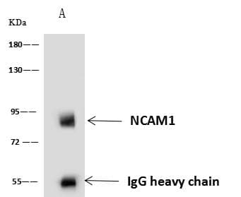 NCAM / CD56 Antibody