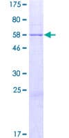 Human ABHD11 Protein (Recombinant GST)