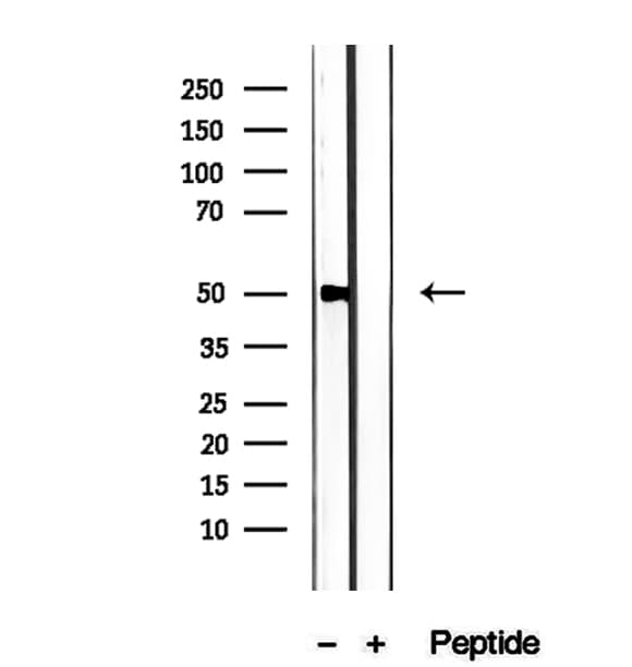 PMPCB / MPP11 Antibody