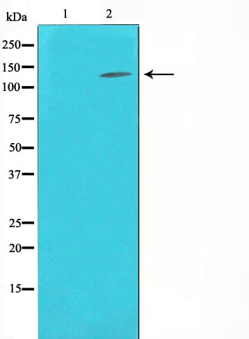 NOS3 / eNOS Antibody