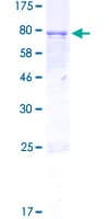Human ANGPTL2 / ARP2 Protein (Recombinant GST)