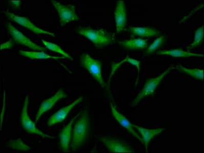Polyclonal Rabbit anti-Human SBDS Antibody (IHC, IF)
