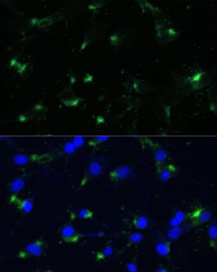 ENO1 / Alpha Enolase Antibody