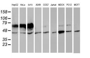 IDS / Iduronate 2 Sulfatase Antibody (clone OTI4G2)