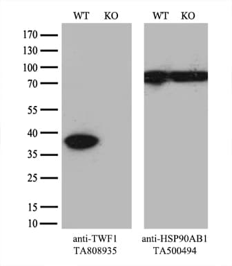 TWF1 / PTK9 Antibody (aa140-384, clone OTI5C12)