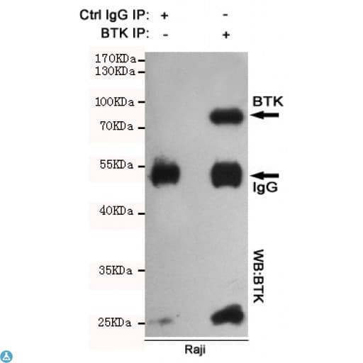 BTK Antibody