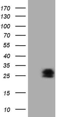 PMP22 Antibody (clone OTI5D1)