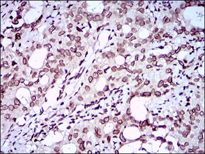 Monoclonal Mouse anti-Human ZEB1 / AREB6 Antibody (clone 2A8A6, aa967-1108, IHC, IF, WB)