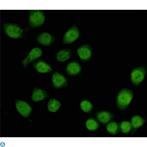 TBL1X / TBL1 Antibody