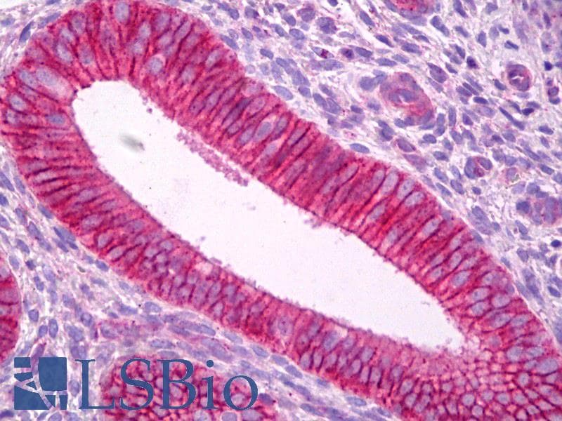 IHC-plus™ KCNA5 / Kv1.5 Antibody (C-Terminus)