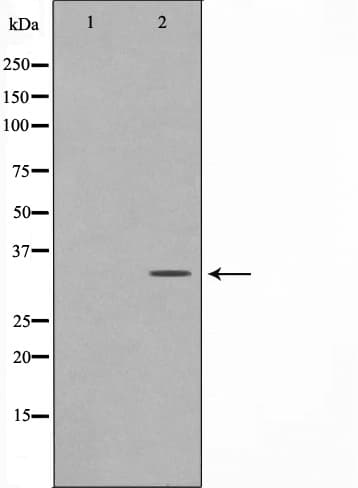 Polyclonal Rabbit anti-Human ZRANB2 / ZNF265 Antibody (IF, WB)