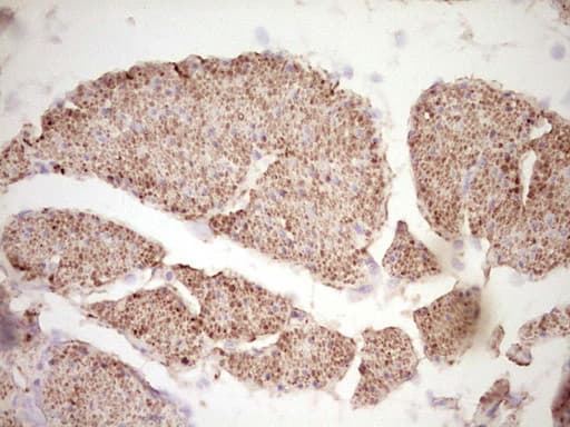 Monoclonal Mouse anti-Human DMN / Desmuslin / Synemin Antibody (clone OTI5G1, Carrier-free, aa329-580, IHC)