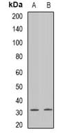 GJB3 / CX31 / Connexin 31 Antibody