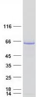 Human GAD1 / GAD67 Protein (Recombinant Myc-DDK (Flag))