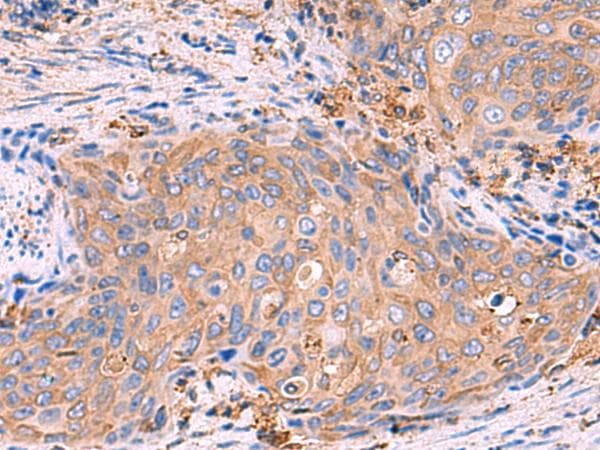 Polyclonal Rabbit anti-Human G6PC / Glucose-6-Phosphatase Antibody (IHC)