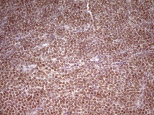 NR2C2 / TAK1 Antibody (aa1-241, clone OTI1F3)