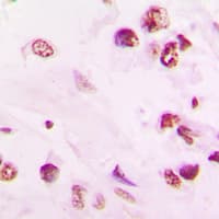 Polyclonal Rabbit anti-Human Vitamin D Receptor / VDR Antibody (aa196-235, IHC, IF, WB)